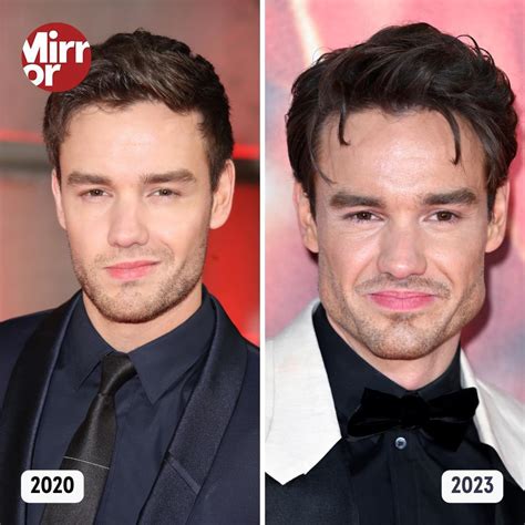 liam payne before and after.